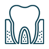 Periodontal surgeries