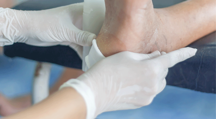 Diabetic Foot